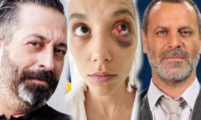 Cem Yılmaz’dan sevgilisi Deniz Bulutsuz’u darp ettiği iddia edilen Ozan Güven ile ilgili açıklama..