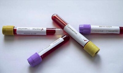 Çok konuşulacak rapor! Coronavirüsten iki ülkeyi sorumlu tuttular!.