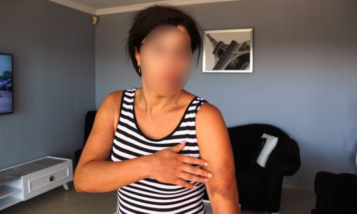 Muğla’da tanımadığı kadını levye demiriyle darbeden adam serbest bırakıldı!.