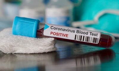 Coronavirüs partisi sonu oldu!.