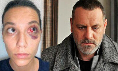 Ozan Güven’in hastanelik ettiği sevgilisinin savcılık ifadesi ortaya çıktı!. Ayrıntılar dehşet verici!.