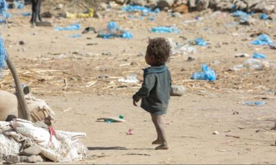 Yemen’de insanlık dramı yaşanıyor! 10 milyon insan acil gıda sıkıntısıyla karşı karşıya..