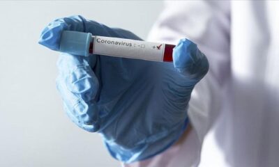 Morityus, Afrika’da tüm coronavirüs hastalarının iyileştiği tek ülke oldu!.