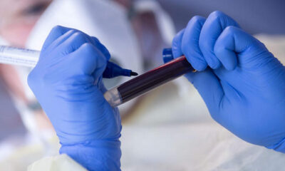 Türk bilim insanları geliştirdi! Coronavirüs tanısı için kullanılacak!.