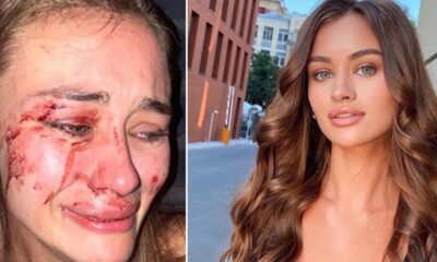 Ukraynalı modelin Çeşme’de saldırıya uğramasından sonra AK Parti’den ilk açıklama…