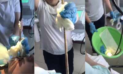 Uyuyan kadının ağzına yılan girdi!.