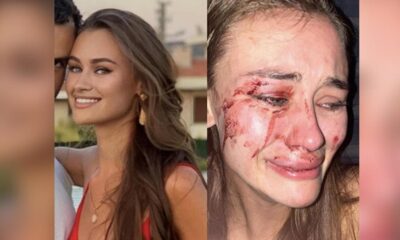 Dünyaca ünlü Ukraynalı top model Kyryliuk, Çeşme’de saldırıya uğradı!.