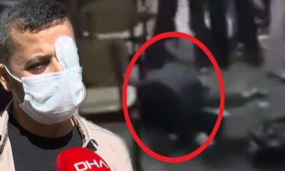 Saldırıya uğrayıp, görme yetisini kaybeden sağlık çalışanı yaşadıklarını anlattı! “Yumruğu atınca gözüm patladı!.”