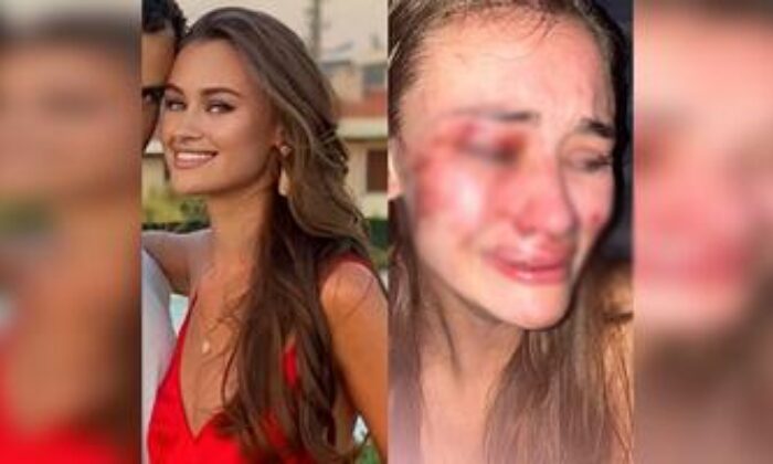 Çeşme’de dayak yiyen Ukraynalı model coronavirüse yakalandı!.