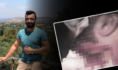 Asistan doktor Kadir Songür’ü jiletle yaralayan sanık hakkında 20 yıl hapis cezası verildi!.