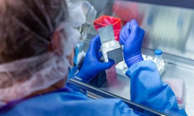 Coronavirüsün yeni belirtileri ortaya çıktı! Ensefalopati nedir?.