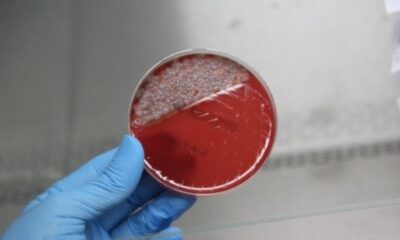 Maskeleri uzun süre takınca üreyen bakteriler laboratuvarda gözlemlendi!.