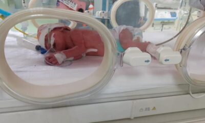 23 yaşındaki kadın çift rahimden birer bebek dünyaya getirdi!.