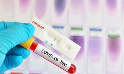 Sağlık Bakanlığı harekete geçti! Coronavirüs testi için alınan fazla paralar iade edilecek!.
