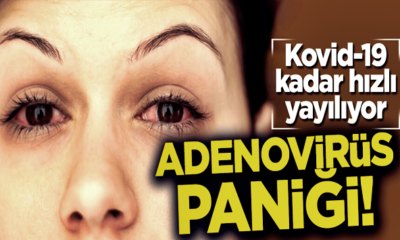 Şimdi de Adenovirüs! Covid-19 kadar hızlı yayılıyor!. (video haber)