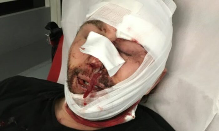 Rus köpeği Esad’ın zulmünden kaçan Suriyeli gazeteciye Fransız polisinden öldüresiye dayak…