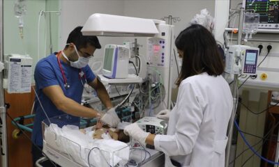 Suriye’de doğan yapışık ikizler Türkiye’ye getirildi!.