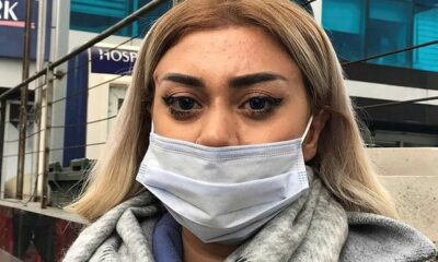 Bir estetik faciası daha! “Dünyaca ünlü doktor” yalanına kandı hayatının şokunu yaşadı!.