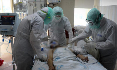 Coronavirüs neden öldürüyor?. Sonuç otopsi bulgularında ortaya çıktı!.