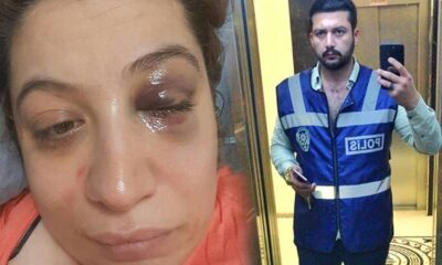 Şiddet gördüğü eski eşi serbest bırakılan Rüya: “Ne zaman öleceğimi düşünüyorum!.”