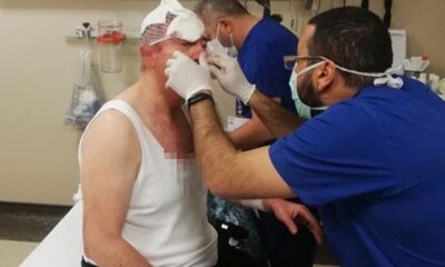 Selçuk Özdağ’a saldıran 2 şüpheli gözaltına alındı!.