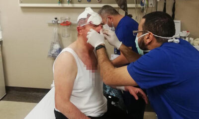 Saldırıya uğrayan Gelecek Partisi Genel Başkan Yardımcısı Selçuk Özdağ taburcu edildi!.