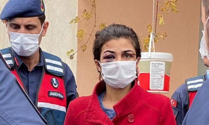 Kendisine işkence yapan kocasını öldüren kadın tutuklandı!.