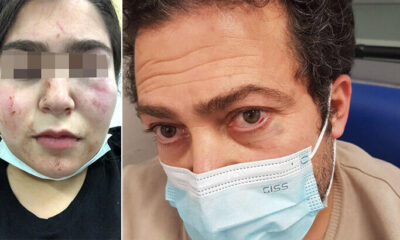 Alman polisi 17 yaşında ki Türk kızını ve babasını hastanelik etti!.