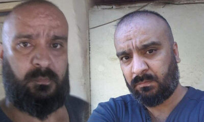 Kardeşi tarafından vurulmuştu, hastanede hayatını kaybetti!.