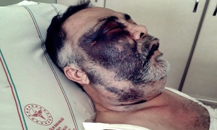 Park meselesi yüzünden darp edilen yüzde 90 engelli vatandaş yaşamını yitirdi!.