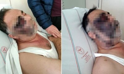 Böyle vicdansızlık görülmedi! Engelli vatandaşı öldüresiye dövdüler!.