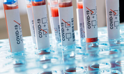 6 Şubat verileri açıklandı! Türkiye’nin küresel salgınla mücadelesinde son durum..