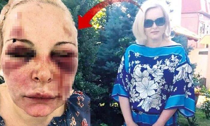 Ataşehir’de dehşet! Rus kadına otelde günlerce işkence edildi!.