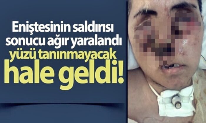 Diyarbakır’da enişte dehşeti! Gözlerini kaybetti, yüzü tanınamaz hale geldi!.