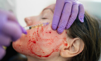 Vampir yüz bakımı! Deri altına kan enjekte eden güzellik uzmanı 24 suçtan yargılanacak!.