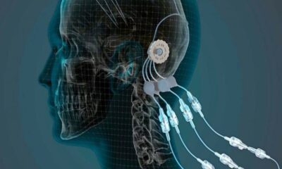 Parkinson hastalığına kızılötesi ışık tedavisi..