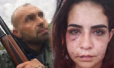 “Ölmek istemiyorum” diyerek yardım isteyen genç kadını darp eden eski erkek arkadaşı tutuklandı!.