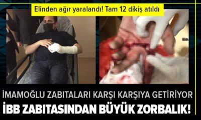 İBB zabıtalarından zorbalık! Ümraniye Belediyesi zabıta memurunun eli yarıldı!. (video haber)