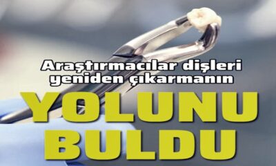 Japonlar dişleri yeniden çıkarmanın yolunu buldu!.