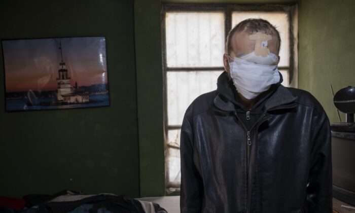 Cilt kanseri nedeniyle yüzünü kaybetti, hayatı kabusa döndü!.