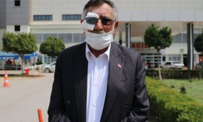 50 kuruş için gözünden oldu!.