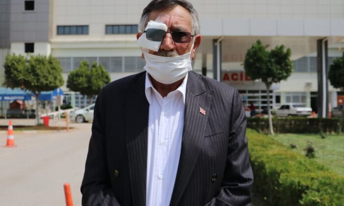 50 kuruş için gözünden oldu!.