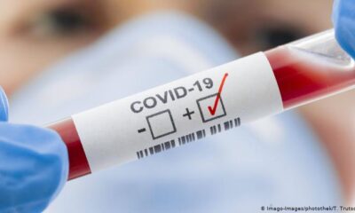 7 Mayıs verileri açıklandı! Covid-19 pandemisinde son durum..