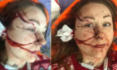 İstanbul’da falçatalı koca dehşeti! “Yaşamak istiyorum!.”