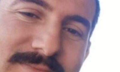 Sakarya’da dernek başkanından hacamata gelen kadınlara taciz..