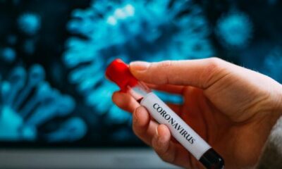 12 Haziran verileri açıklandı! Coronavirüs pandemisinde son durum..