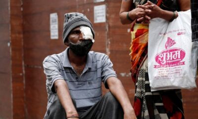 Hindistan’da kara mantar dehşeti! Ölü sayısı 4 bin 332’ye ulaştı!.