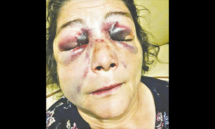 Konu CHP olunca Feministler salağa yatıyor!. Tecavüz olaylarında sonra şimdi de şiddet furyası başladı!.