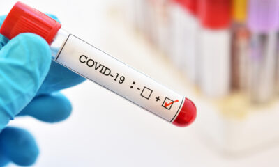 22 Temmuz coronavirüs verileri açıklandı! Vaka sayısı 9 binin üzerinde..