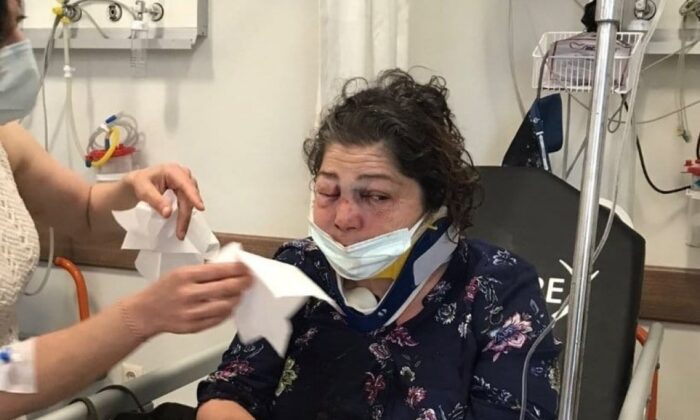 CHP’li belediye başkanının adamları tarafından darp edildiğini söyleyen kadın tanınmaz hale geldi!.